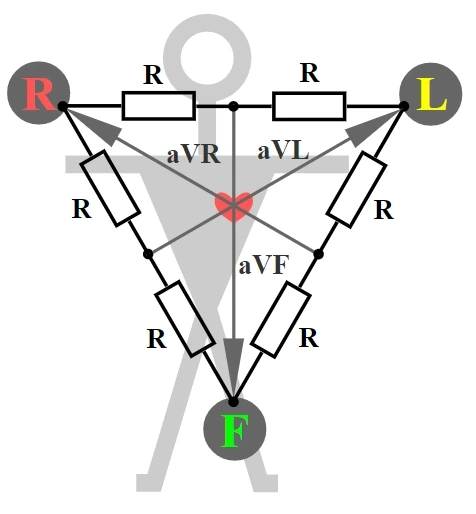EKG Schema Extremitätenableitung nach Goldberger StudySmarter