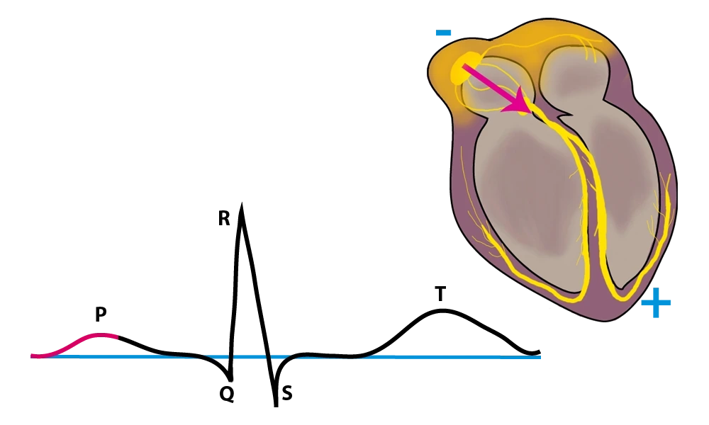EKG, EKG P-Welle, StudySmarter