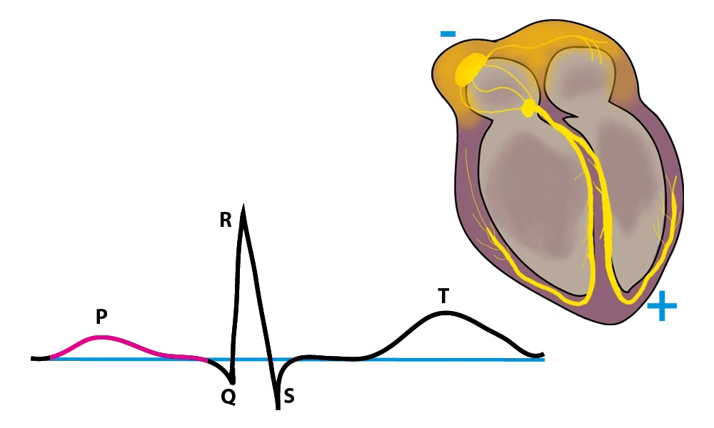 EKG, EKG PQ-Zeit, StudySmarter