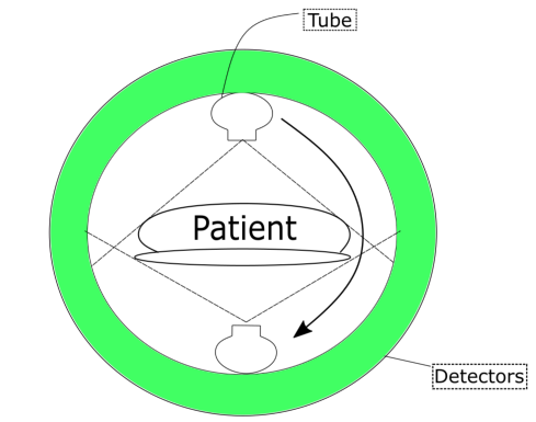 Les tomodensitomètres Mécanisme d'un tomodensitomètre StudySmarter