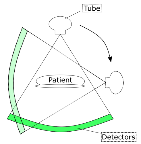 Les tomodensitomètres Mécanisme d'un tomodensitomètre StudySmarter
