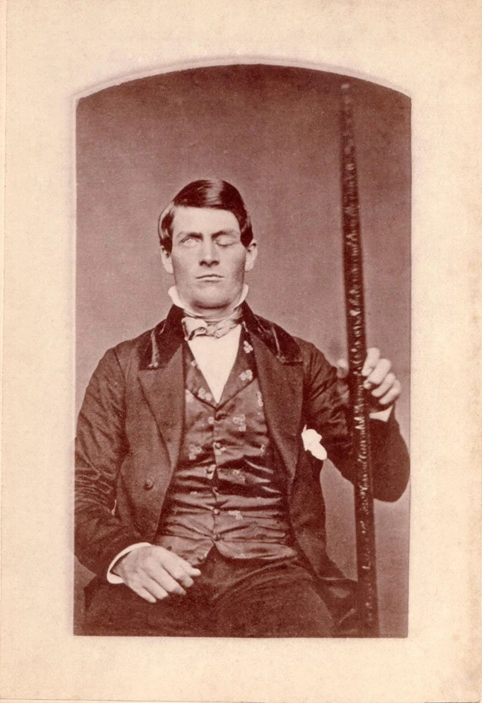 Psychologie im 19. Jahrhundert Phineas Gage mit seiner Eisenstange StudySmarter