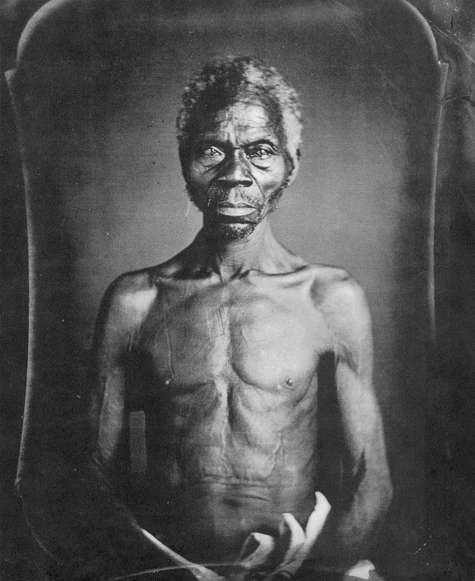 Une photo en noir et blanc d'une personne réduite en esclavage, Rentry Taylor StudySmarter.
