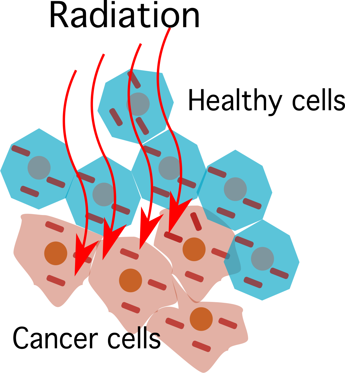 Physique médicale. Thérapie du cancer. Rayonnement. StudySmarter