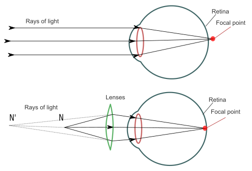 œil, Schéma de correction de l'hypermétropie, StudySmarter