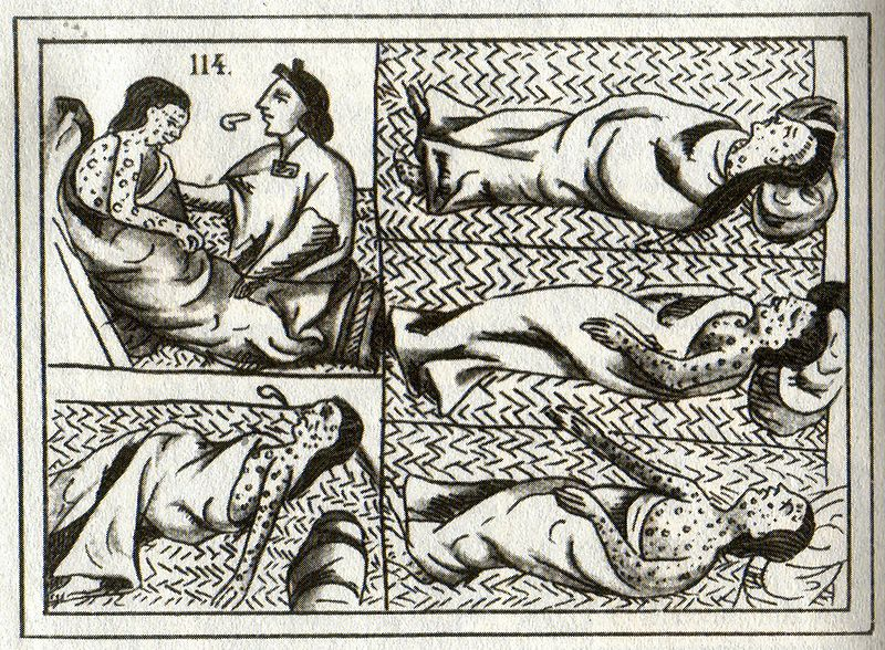 Columbian Exchange, Diseases Smallpox affects the Aztecs, 91Ó°ÊÓ