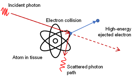 Absorption des rayons X Diffusion Compton StudySmarter
