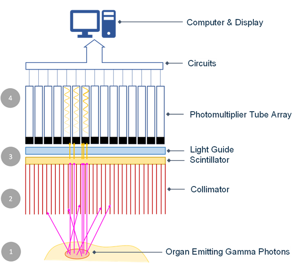 Gamma Camera: Diagram, Isotopes, Scan & Applications