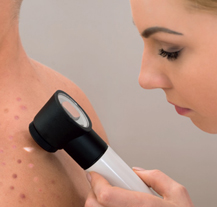 Ve stanu na náměstí Republiky si lidé mohou nechat vyšetřit znaménka