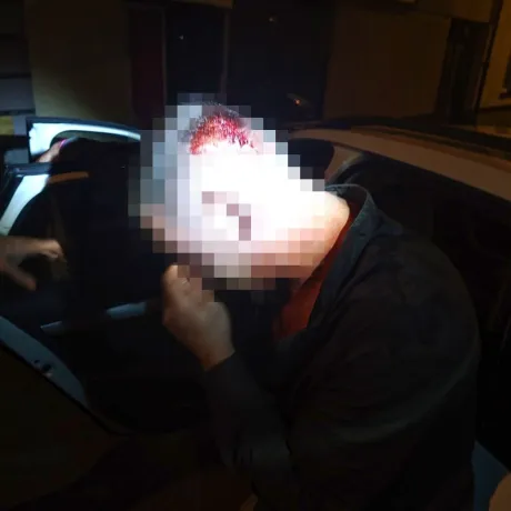 Noční klid přerušil pád a zranění na hlavě