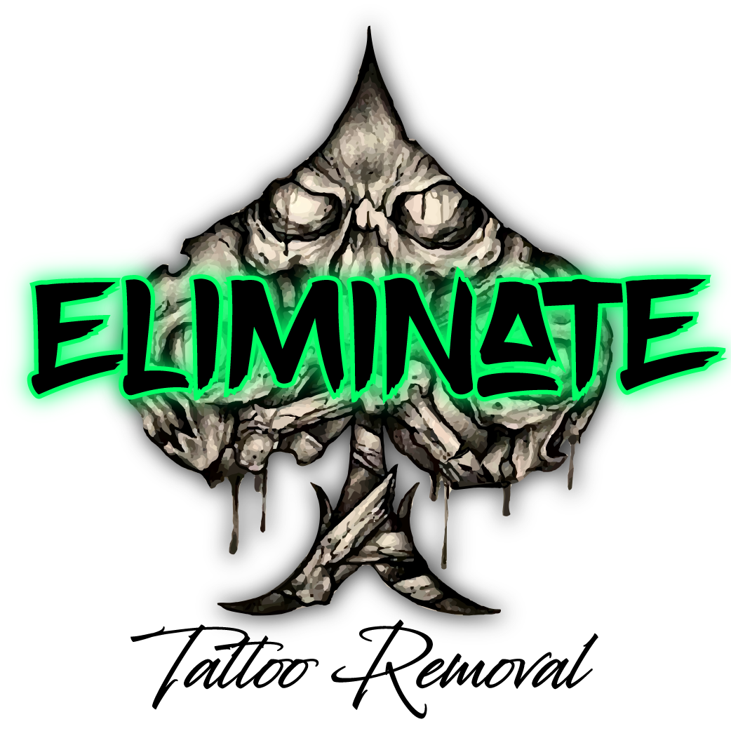 Eliminate Tattoo Removal