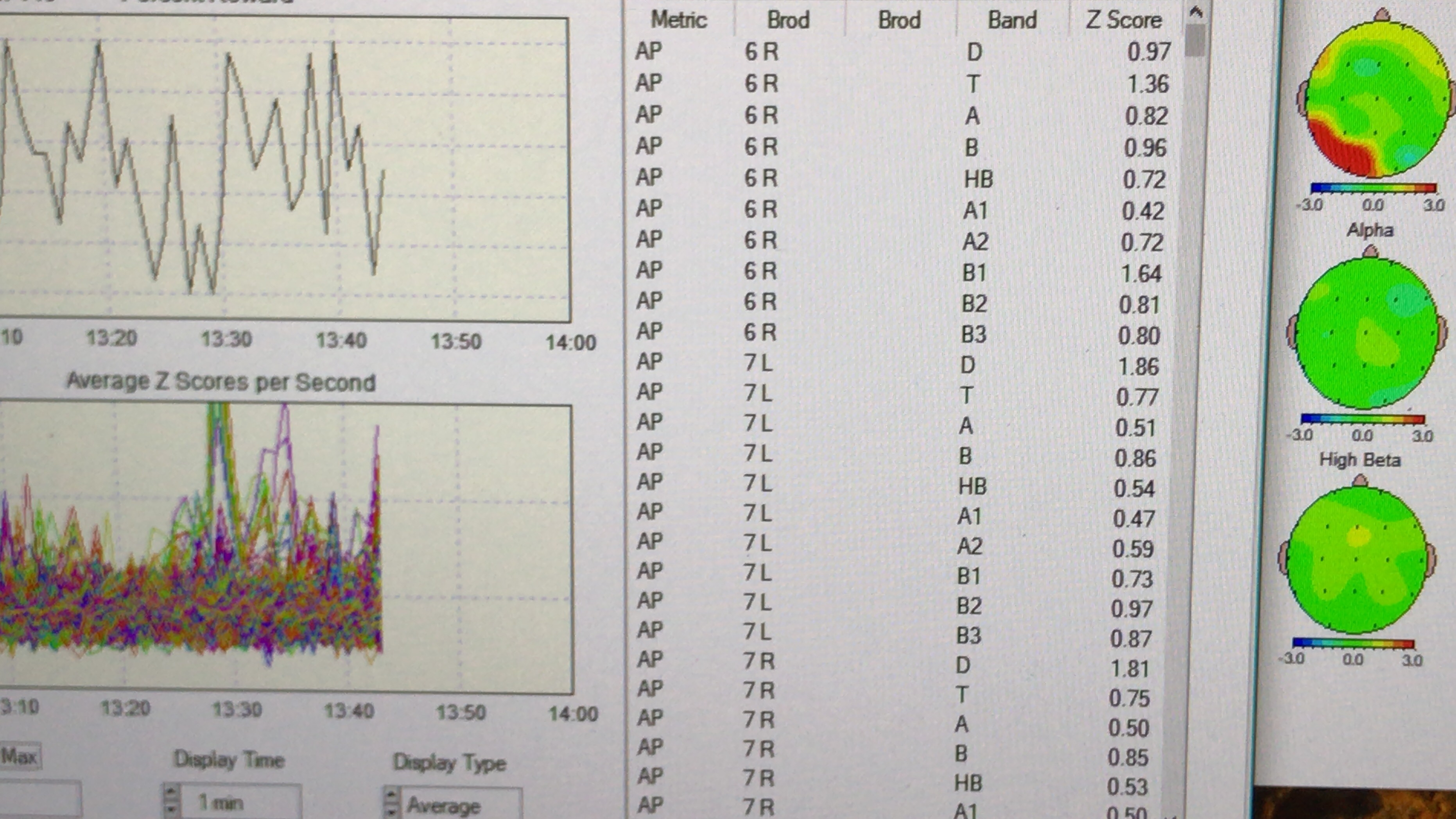 Fotos de Praxis für Psychotherapie und Neurofeedback Fotos de Praxis für Psychotherapie und Neurofeedback