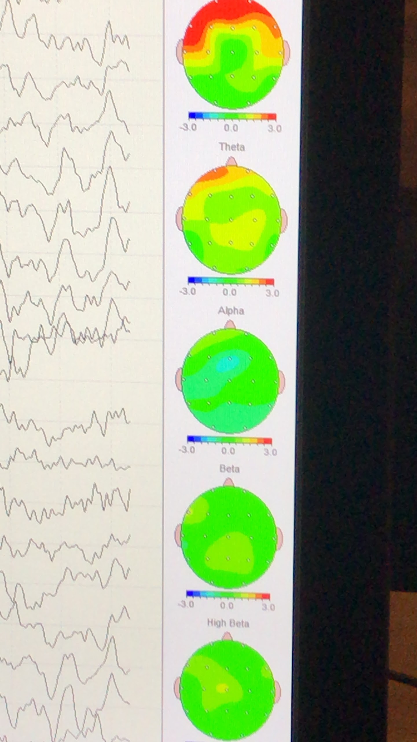 Foto de Praxis für Psychotherapie und Neurofeedback Foto de Praxis für Psychotherapie und Neurofeedback