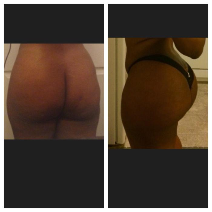 la Piel Perfecta laser center