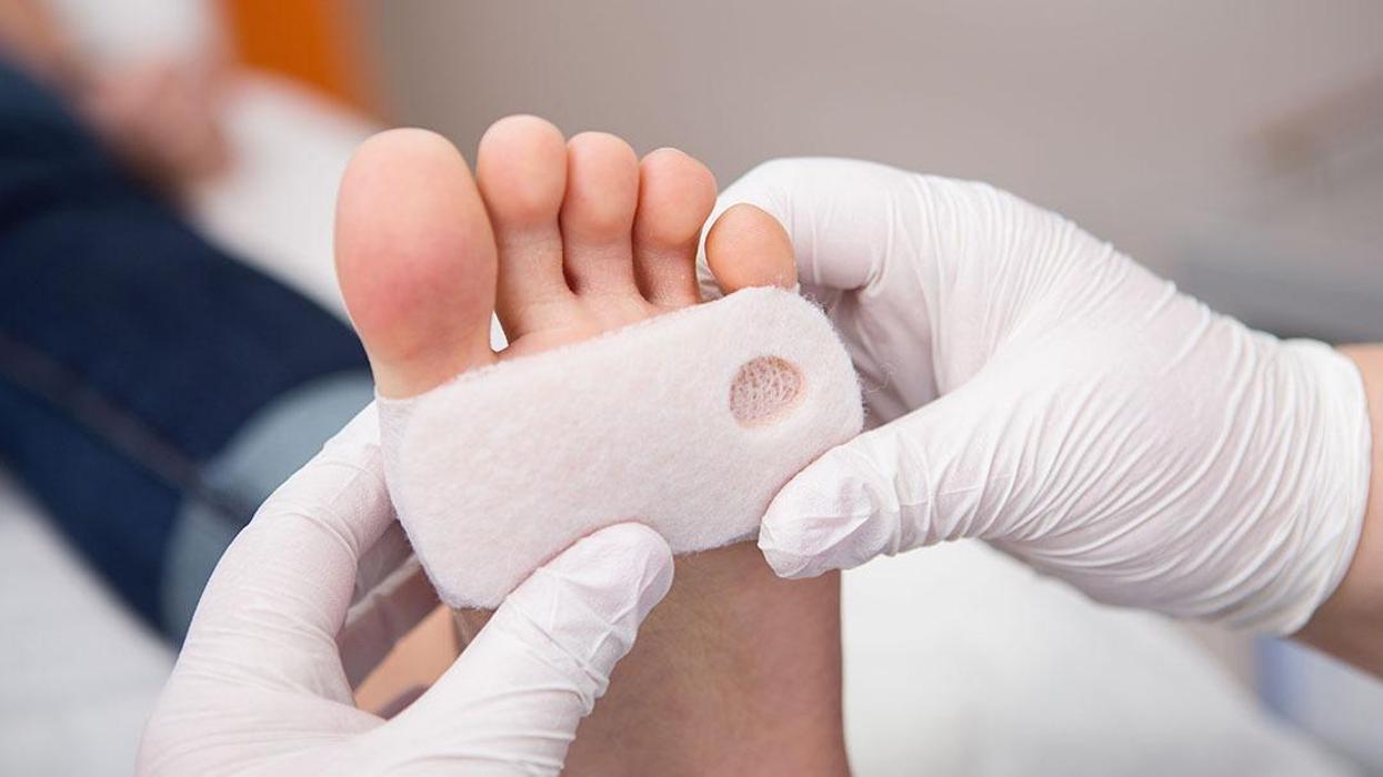 Seneca Family Foot Care: Dr. Gerald M. Erskine - Ronceverte, WV