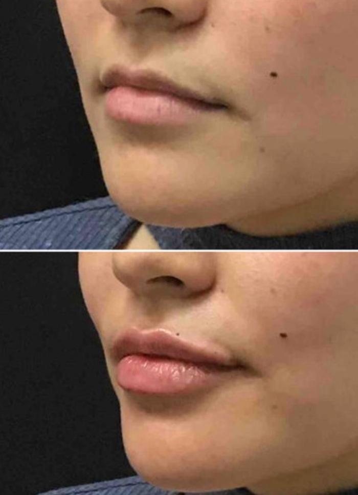 Purity Aesthetics - Stateline, NV