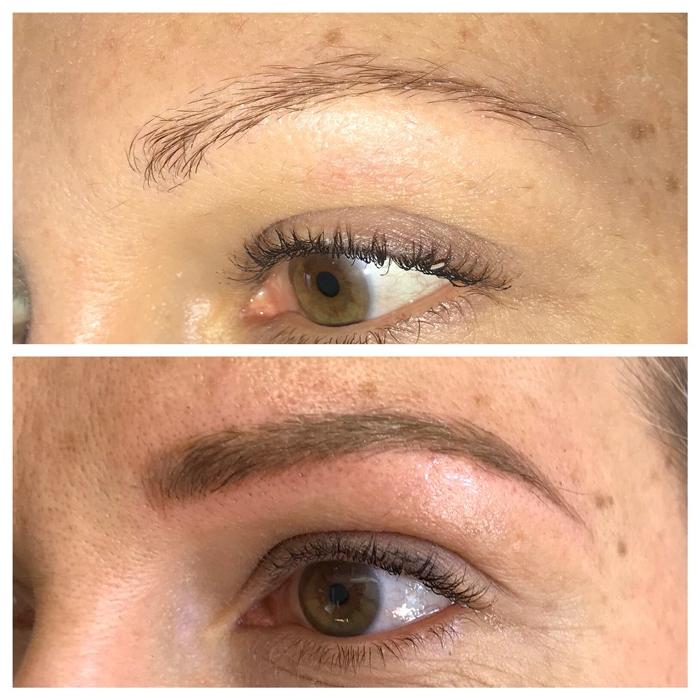 Purity Aesthetics - Stateline, NV