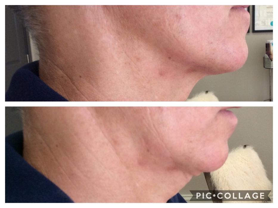 Purity Aesthetics - Stateline, NV