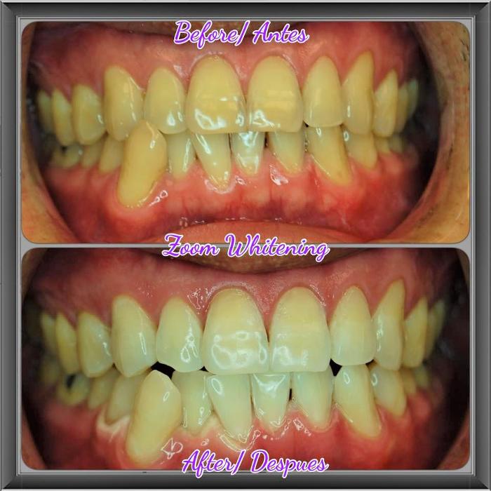 DJ Dental Group - La Palma, CA