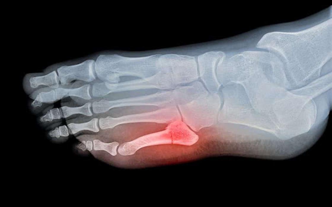 Phoenician Foot & Ankle Specialists, LLC. - Scottsdale, AZ