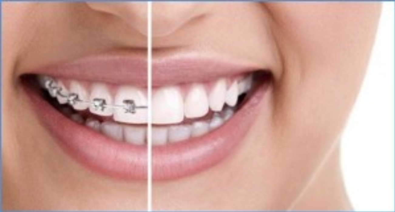 Michael Dierkes, DDS - Roswell, GA