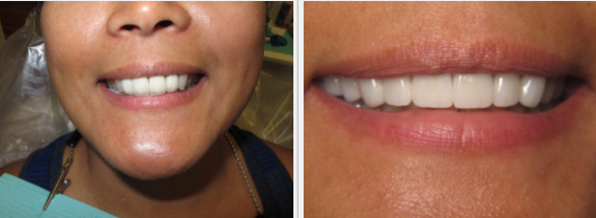 NC Family Dental - Escondido, CA