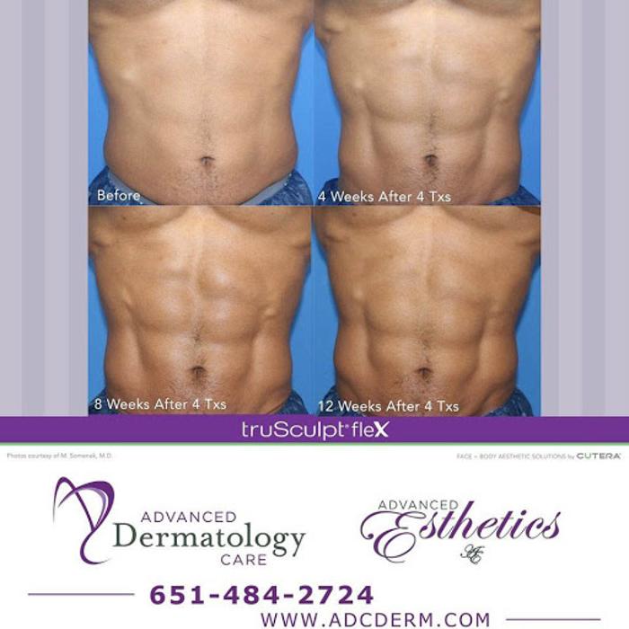 Advanced Dermatology Care - Forest Lake, MN