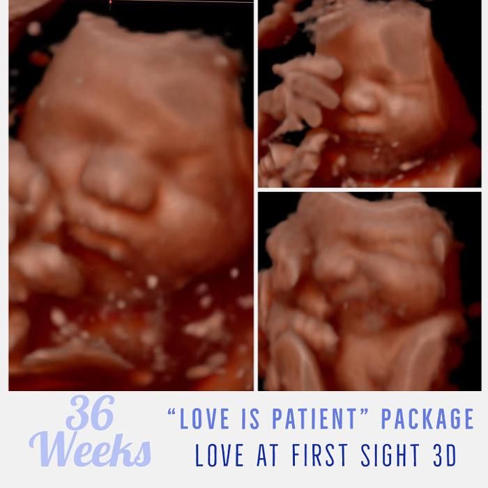 Love At First Sight 3D, LLC - Berwick, PA