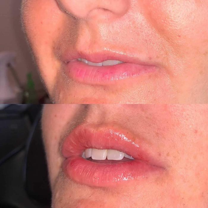 Shape it Up Contouring - Murrieta, CA