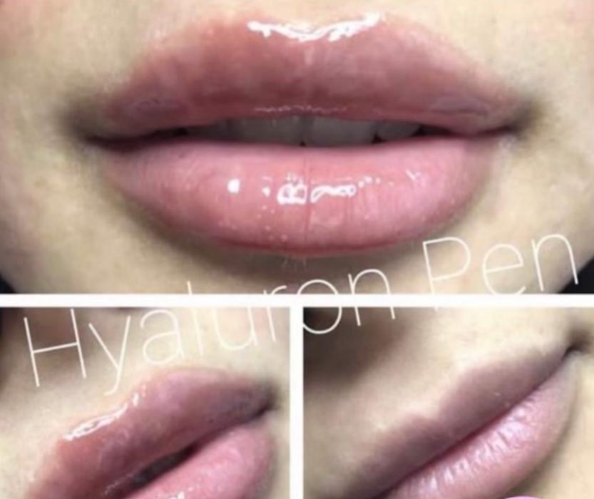 Shape it Up Contouring - Murrieta, CA