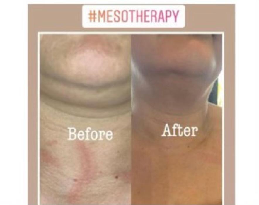 Shape it Up Contouring - Murrieta, CA