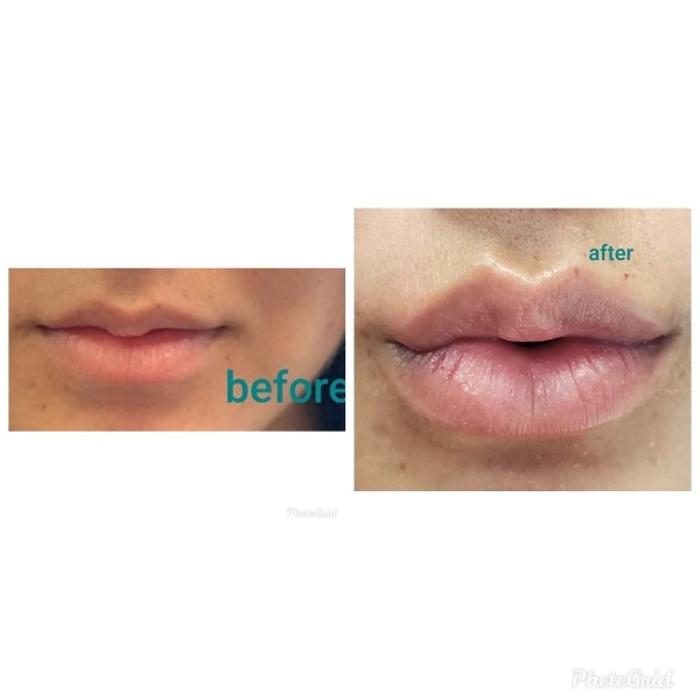 Shape it Up Contouring - Murrieta, CA