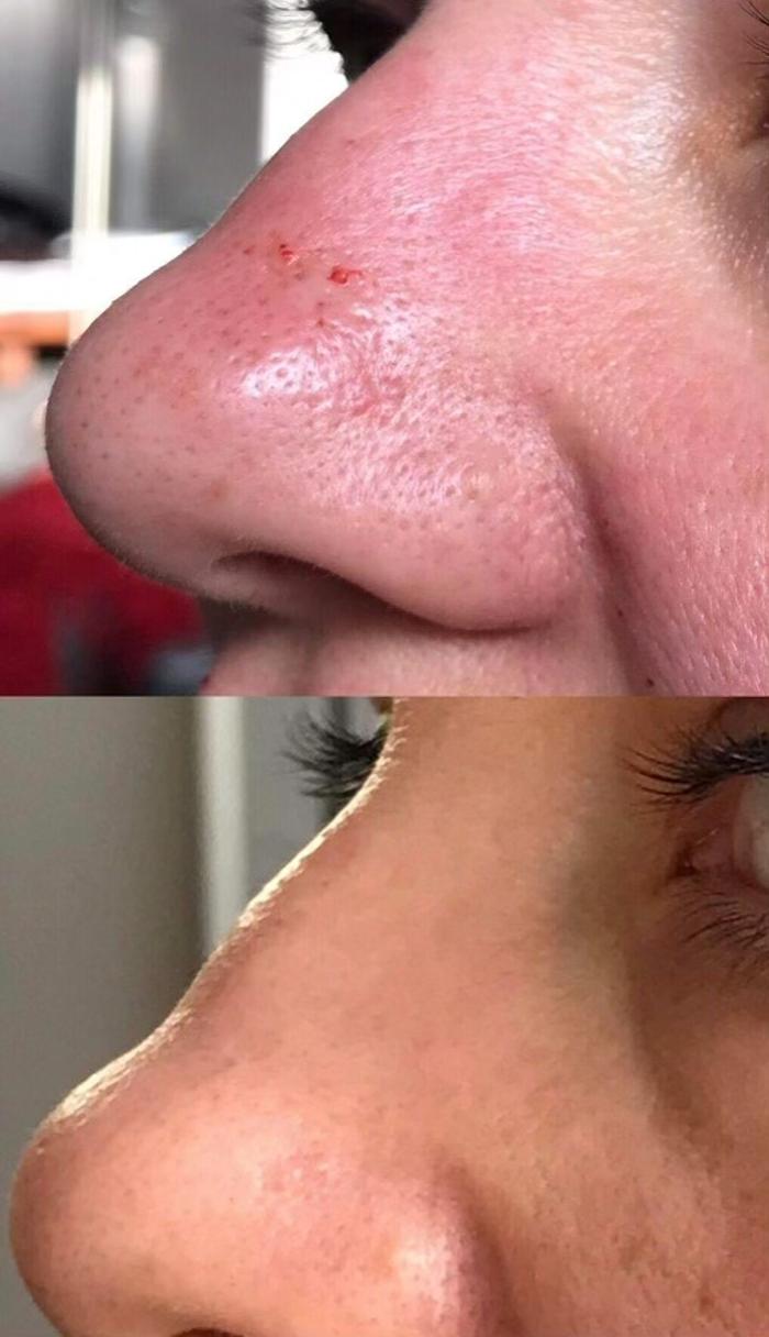 Shape it Up Contouring - Murrieta, CA