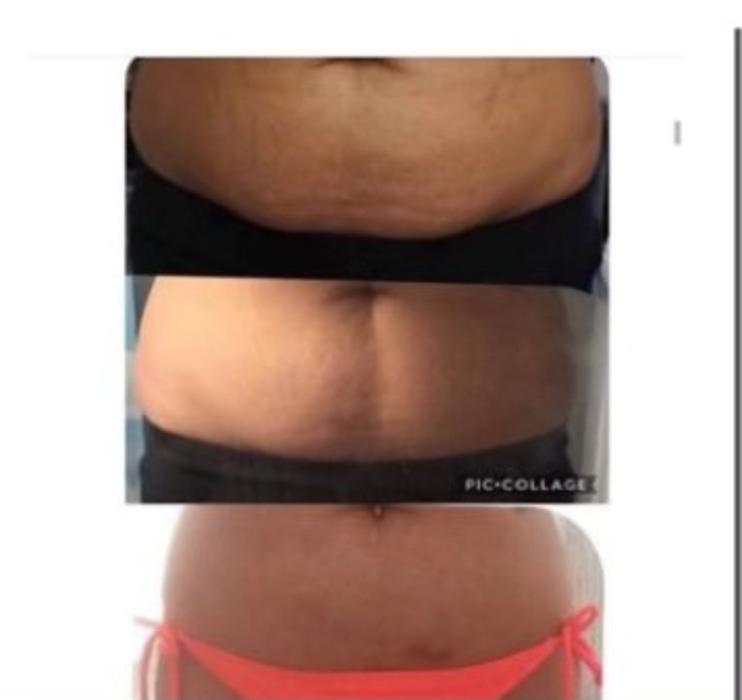 Shape it Up Contouring - Murrieta, CA
