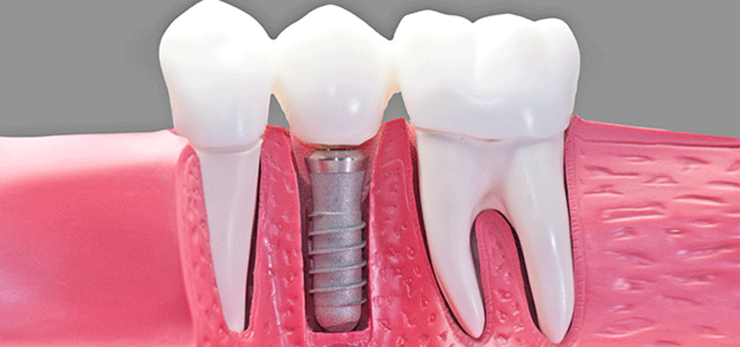 Greg DeVor, DDS - Lakewood, OH