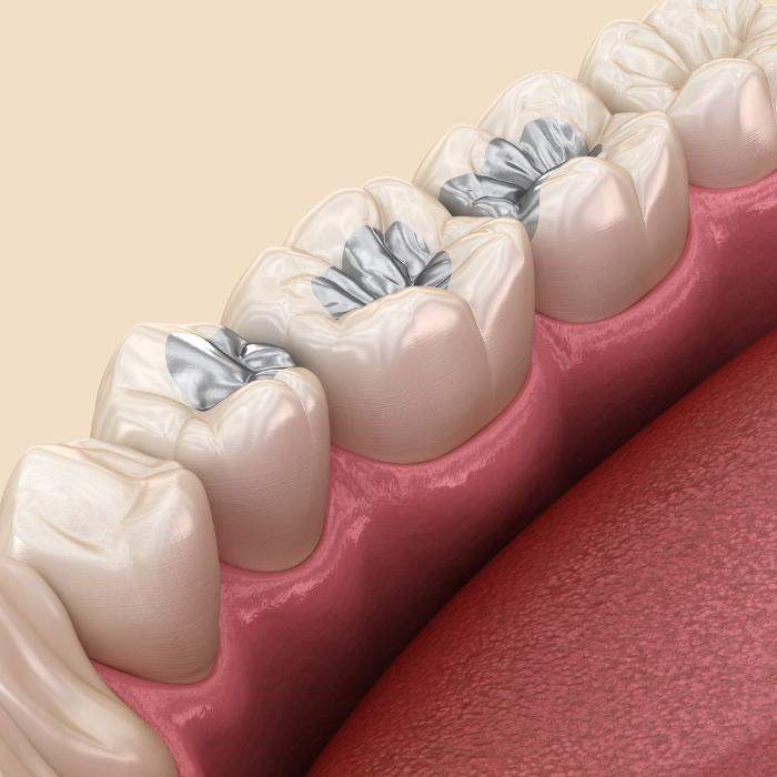 Greg DeVor, DDS - Lakewood, OH