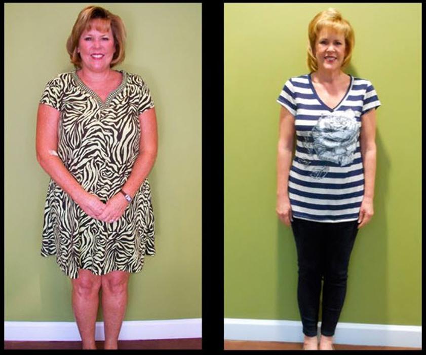 Calla Slimspa Medical Weight Loss Center - Winter Park, FL
