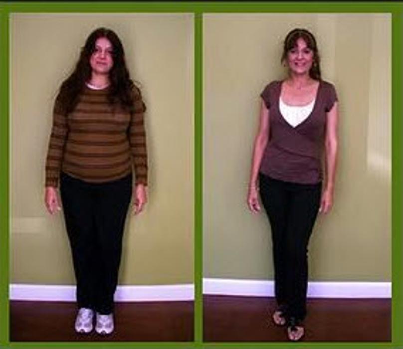 Calla Slimspa Medical Weight Loss Center - Winter Park, FL