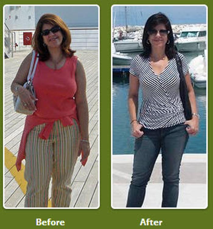 Calla Slimspa Medical Weight Loss Center - Winter Park, FL
