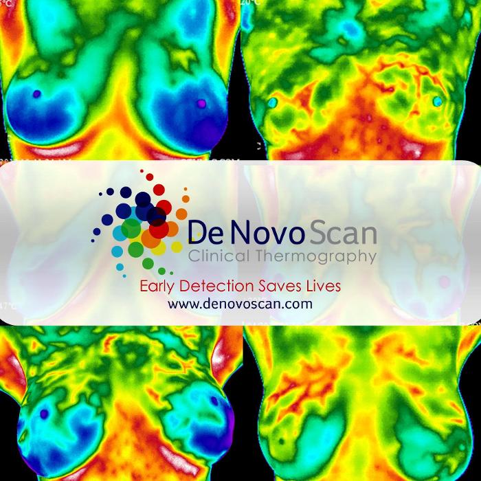 De Novo Scan, Clinical Thermography - Scottsdale, AZ