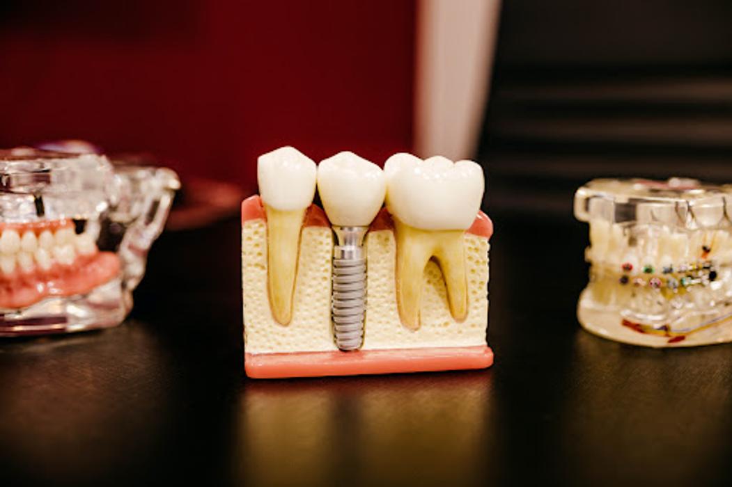 Grove Health Dental - Maple Grove, MN
