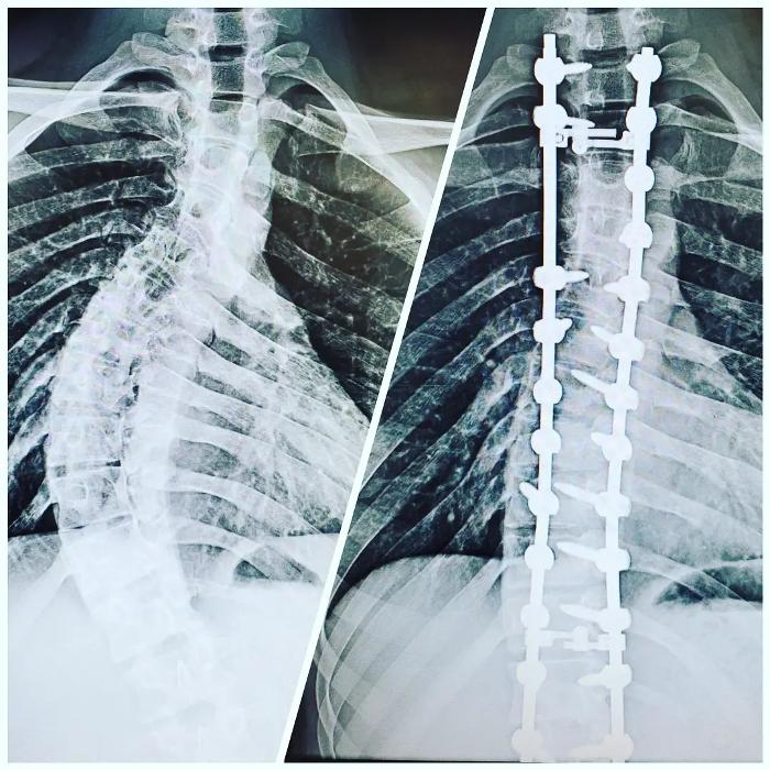 Centers for Neurosurgery, Spine, & Orthopedics Image