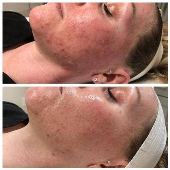 Skin Goals Local EC - Elizabeth City, NC