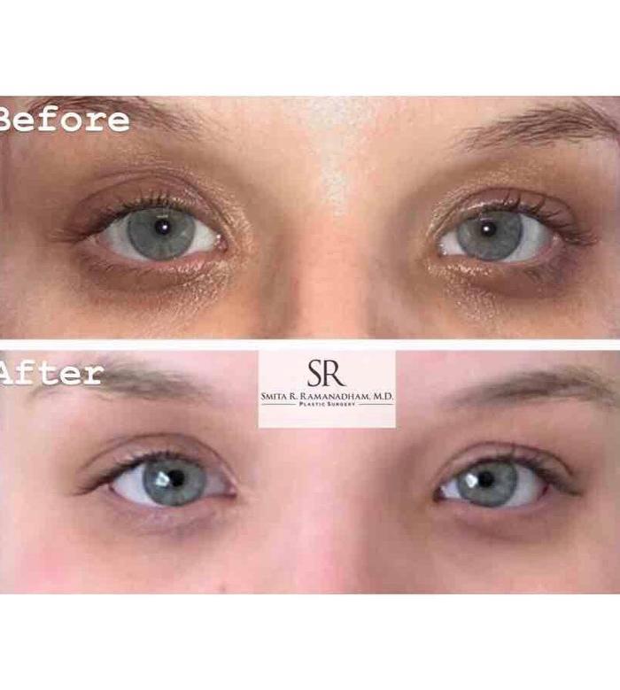 SR Plastic Surgery P.C.- Smita R. Ramanadham, M.D., F.A.C.S - East Brunswick, NJ