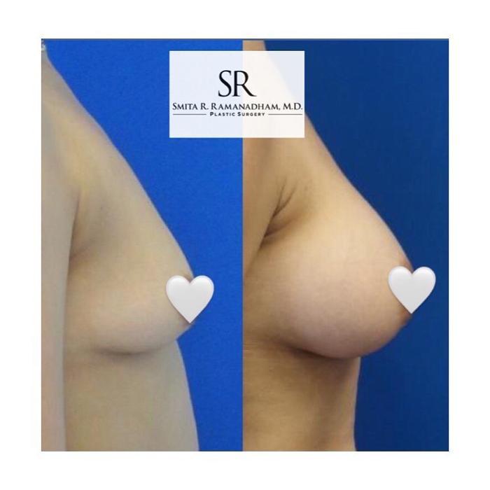 SR Plastic Surgery P.C.- Smita R. Ramanadham, M.D., F.A.C.S - East Brunswick, NJ