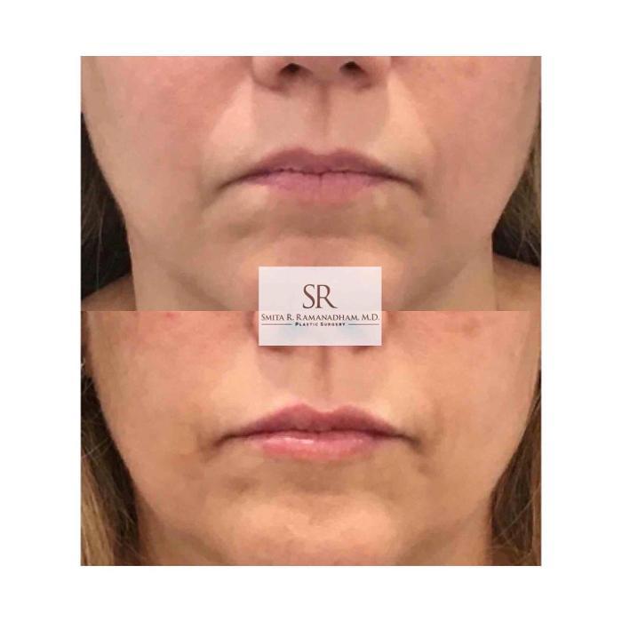 SR Plastic Surgery P.C.- Smita R. Ramanadham, M.D., F.A.C.S - East Brunswick, NJ