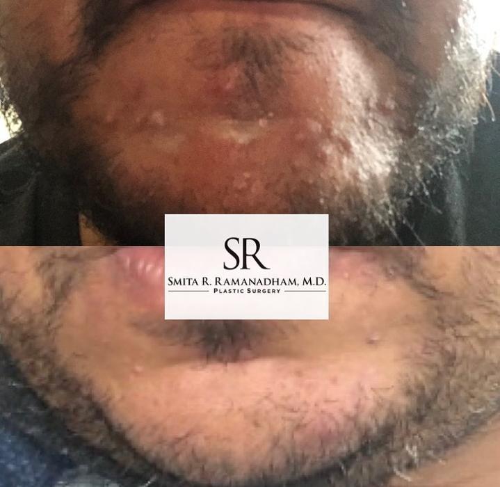 SR Plastic Surgery P.C.- Smita R. Ramanadham, M.D., F.A.C.S - East Brunswick, NJ