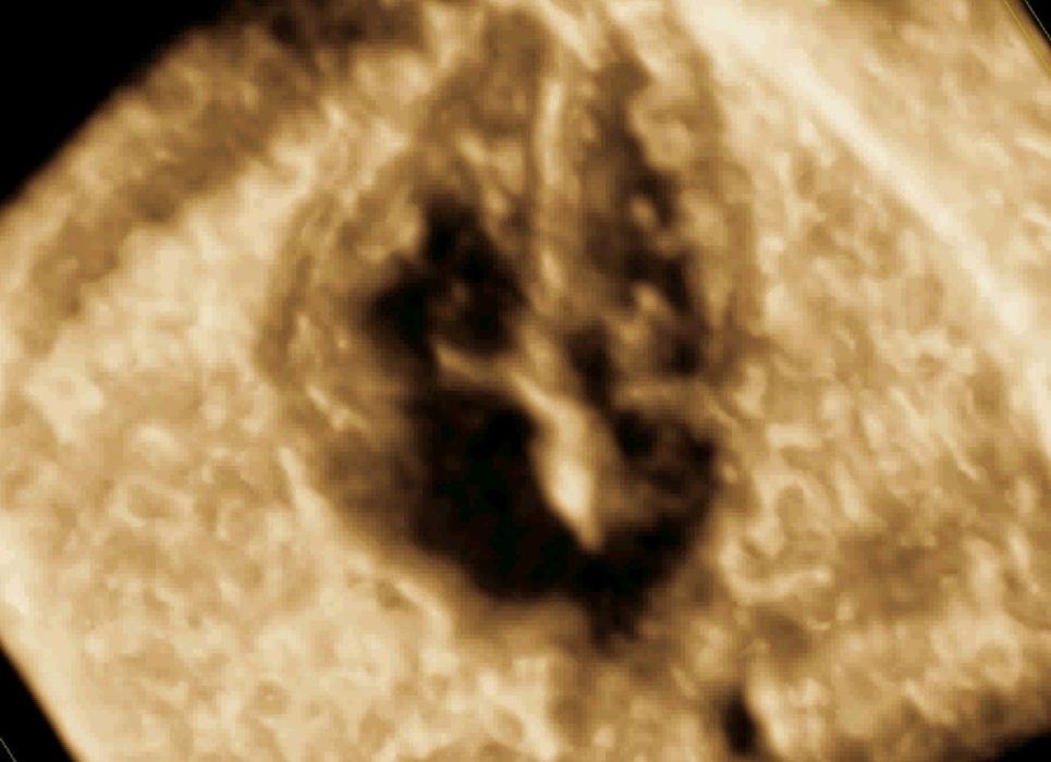 Zentrum für Pränatalmedizin an der Elbe, Willy-Brandt-Straße in Hamburg