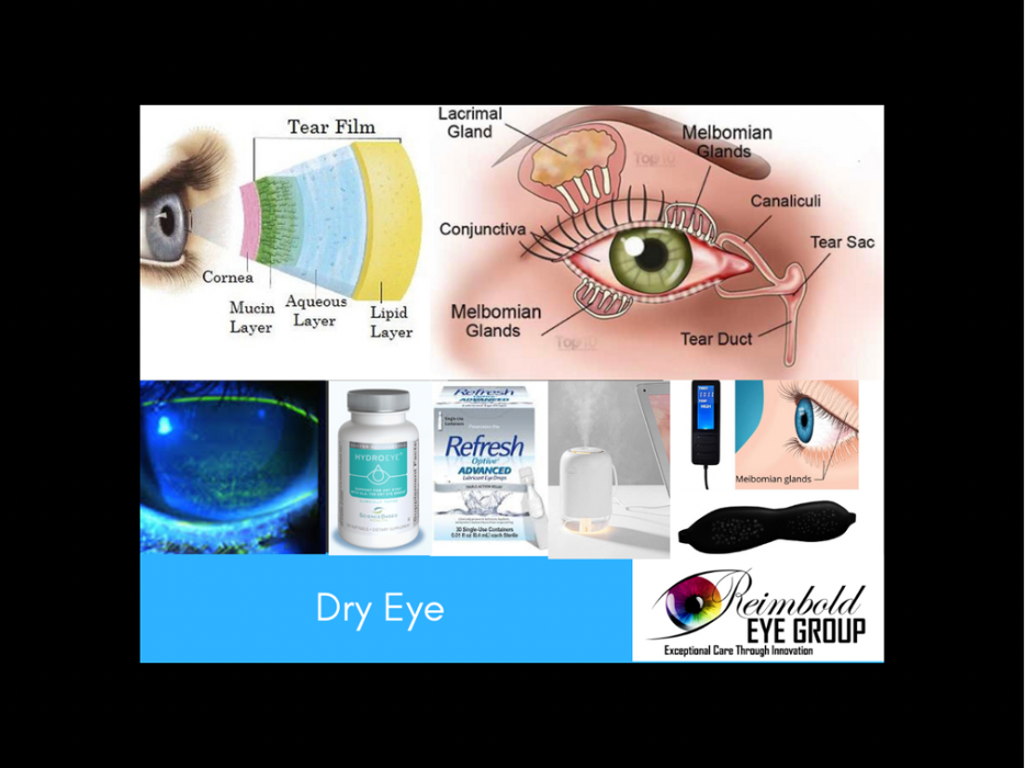 Reimbold Eye Group - Alpharetta, GA