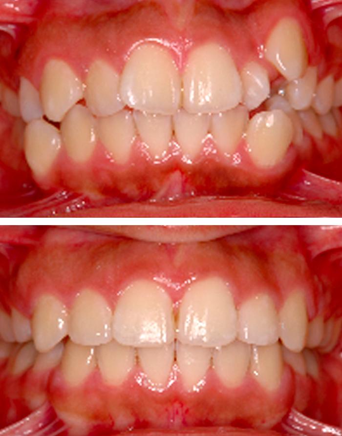 Dr. Kim's Dentistry - Moreno Valley, CA